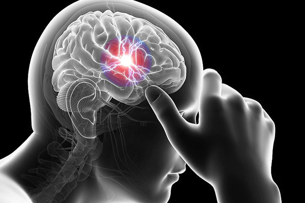 cure headache by homeopathy medicine