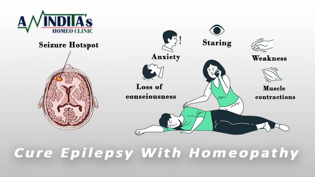 Treat Epilepsy – Dr. Anindita Mukherjee (One of the best homeopathy doctor in Kolkata)