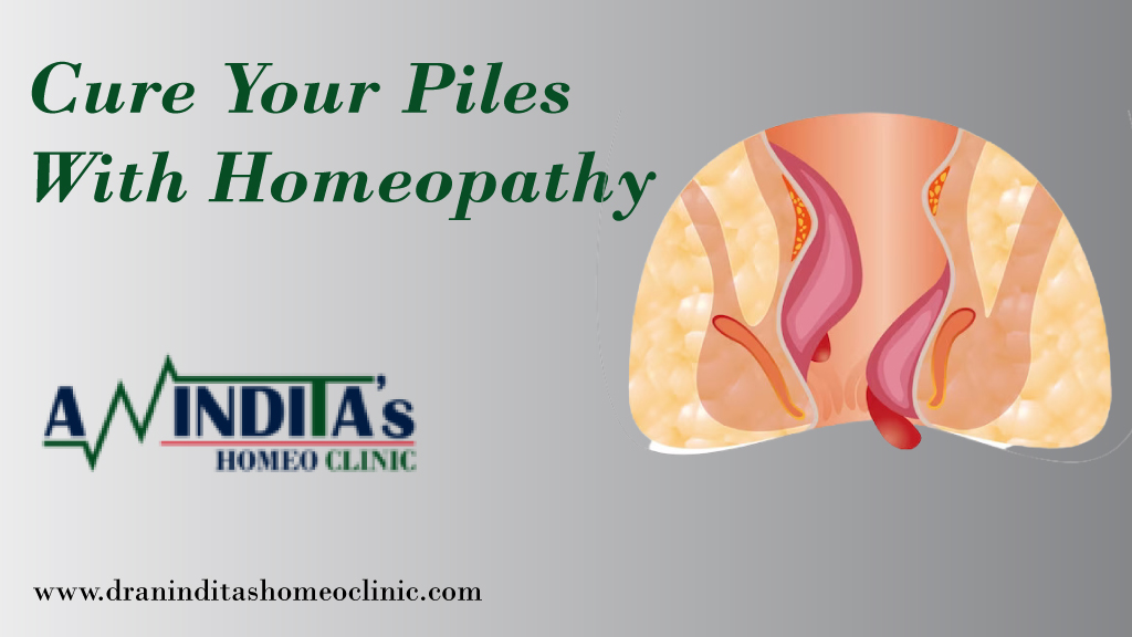 Cure Piles With Homeopathy in Kolkata – Dr. Anindita Mukherjee (One of the best homeopathy doctor in Kolkata)